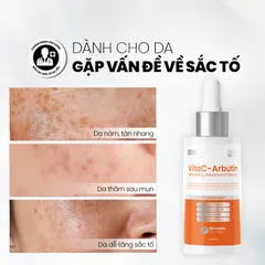 [Tặng SRM 30ML] Serum Trắng Sáng Da MD Care VitaC Arbutin 30ml - Dưỡng Ẩm, Làm Sáng Da nhanh+ 2 nạ NMF
