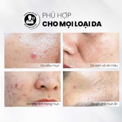 Tẩy Tế Bào Chết Kiểm Soát Dầu Mụn MD CARE AntiAc Exfo - Giảm Viêm, Sạch Da Hiệu Quả, Dành Cho Da Dầu Mụn