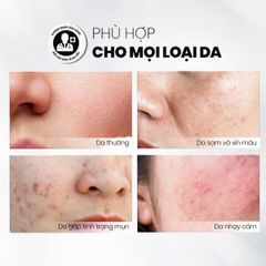 Tẩy Tế Bào Chết MD CARE Glow Exfo - Làm Sáng Da, Mờ Thâm, Cung Cấp Độ Ẩm Cho Làn Da Khỏe Mạnh