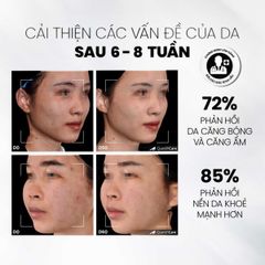 Tẩy Tế Bào Chết MD CARE Mande Exfo - Căng Bóng, Cấp Ẩm, Làm Sáng Da, Giúp Da Mịn Màng Tươi Trẻ, Phù Hợp Mọi Loại Da