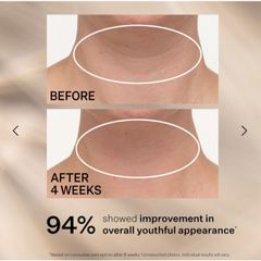 Kem Dưỡng Cổ StriVectin TL Advanced - Dưỡng ẩm & Chống Lão Hóa Cho Cổ - Sản Phẩm Mỹ Chất Lượng Cao