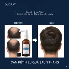 Tinh Chất Ducray Creastim Anti Hair Loss & Growth Serum 50ml – Hỗ Trợ Giảm Rụng, Kích Thích Mọc Tóc, Nuôi Dưỡng Da Đầu