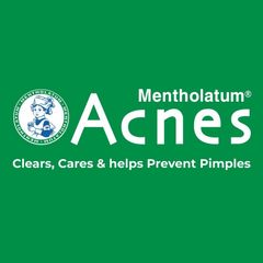 Gel Rửa Mặt Acnes Gentle Wash 100g - Sữa Rửa Mặt Ngăn Ngừa Mụn, Làm Sạch Sâu, Dành Cho Da Nhờn, Cảm Giác Thoải Mái