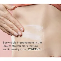 Set Kem Dưỡng Ẩm StriVectin SD Advanced Plus - Giảm Nếp Nhăn và Rạn Da (47ml x 2 tuýp) Mỹ - Làm Sáng Da, Duy Trì Collagen