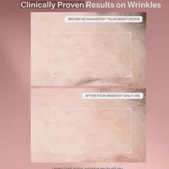 Set Kem Dưỡng Ẩm StriVectin SD Advanced Plus - Giảm Nếp Nhăn và Rạn Da (47ml x 2 tuýp) Mỹ - Làm Sáng Da, Duy Trì Collagen