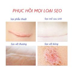 Kem Trị Nám Tàn Nhang Dưỡng Ẩm Da - Chiết Xuất Tự Nhiên & Công Nghệ Tiên Tiến Làm Mờ Sẹo, Phù Hợp Cho Mọi Loại Da