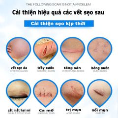Kem Trị Nám Tàn Nhang Dưỡng Ẩm Da - Chiết Xuất Tự Nhiên & Công Nghệ Tiên Tiến Làm Mờ Sẹo, Phù Hợp Cho Mọi Loại Da