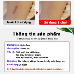 Kem Trị Nám Tàn Nhang Dưỡng Ẩm Da - Chiết Xuất Tự Nhiên & Công Nghệ Tiên Tiến Làm Mờ Sẹo, Phù Hợp Cho Mọi Loại Da