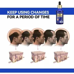 Tinh Chất Mọc Tóc Gừng Nhật Bản 50ml - Dầu Ủ Kích Thích Mọc Tóc Siêu Tốc, Phục Hồi Da Đầu, Trị Tóc Thưa Rụng