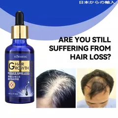 Tinh Chất Mọc Tóc Gừng Nhật Bản 50ml - Dầu Ủ Kích Thích Mọc Tóc Siêu Tốc, Phục Hồi Da Đầu, Trị Tóc Thưa Rụng