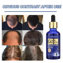 Tinh Chất Mọc Tóc Gừng Nhật Bản 50ml - Dầu Ủ Kích Thích Mọc Tóc Siêu Tốc, Phục Hồi Da Đầu, Trị Tóc Thưa Rụng
