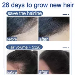 Tinh Chất Mọc Tóc Gừng Nhật Bản 50ml - Dầu Ủ Kích Thích Mọc Tóc Siêu Tốc, Phục Hồi Da Đầu, Trị Tóc Thưa Rụng