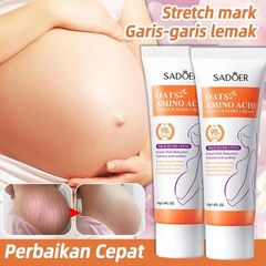 Kem Làm Mờ Rạn Da Anti-Stretch Marks Cream Cho Bà Bầu - Giúp Tái Tạo Da, Giảm Sẹo và Thâm, An Toàn Cho Làn Da Nhạy Cảm