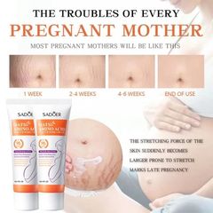 Kem Làm Mờ Rạn Da Anti-Stretch Marks Cream Cho Bà Bầu - Giúp Tái Tạo Da, Giảm Sẹo và Thâm, An Toàn Cho Làn Da Nhạy Cảm