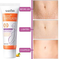 Kem Làm Mờ Rạn Da Anti-Stretch Marks Cream Cho Bà Bầu - Giúp Tái Tạo Da, Giảm Sẹo và Thâm, An Toàn Cho Làn Da Nhạy Cảm