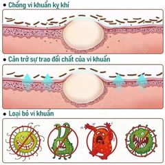 Kem Bôi Vảy Nến 20g - Hỗ Trợ Giảm Ngứa, Sản Phẩm Chăm Sóc Da Vảy Nến, Chàm, Tổ Đỉa, Ghẻ Nước, Hắc Lào, Lang Ben