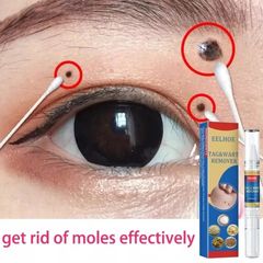 Kem Tẩy Nốt Ruồi & Mụn Cóc - Giải Pháp Làm Sạch Da Hiệu Quả, Dễ Sử Dụng, Chăm Sóc Da Toàn Diện