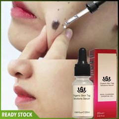 Tinh Chất Tẩy Nốt Ruồi, Mụn Cóc, Tàn Nhang, Mụn Thịt, Mắt Cá - Serum Làm Sáng Da, Khôi Phục Vẻ Đẹp Tự Nhiên Cho Mọi Loại Da