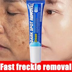 Kem Nám Tàn Nhang Dưỡng Trắng Da Mặt USA 20g - Giúp Làm Mờ Đốm Nâu, Nám và Tàn Nhang, Da Trắng Sáng Tự Nhiên
