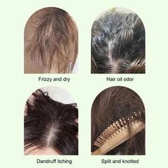 Dầu Gội Sạch Gàu – Phục Hồi Nang Tóc, Ngăn Ngừa Rụng Tóc, Làm Sạch Da Đầu Nhờn, Giảm Ngứa Da Đầu, Dầu Gội Chất Lượng Cao