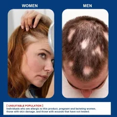 Kem Mọc Tóc Alopecia Hair Growth Cream - Kích Thích Mọc Tóc, Giảm Gãy Rụng, Nuôi Dưỡng Tóc Chắc Khỏe 20g