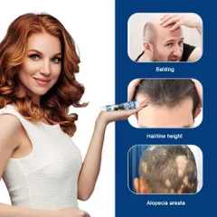 Kem Mọc Tóc Alopecia Hair Growth Cream - Kích Thích Mọc Tóc, Giảm Gãy Rụng, Nuôi Dưỡng Tóc Chắc Khỏe 20g