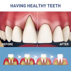 Bút Tẩy Trắng Răng Nha Khoa TEETH Whitening Pen - Giúp Làm Sạch Mảng Bám, Răng Trắng Sáng Tự Nhiên, Tiện Lợi và An Toàn