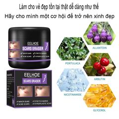 Kem Xóa Sẹo EELHOE - Giải Pháp Hiệu Quả Xóa Sẹo Lâu Năm, Phẫu Thuật và Rạn Da Sau Mang Thai
