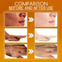 Kem Tẩy Da Chết Peel Da Mặt Vi 100g - Tái Tạo Da, Làm Trắng Da, Giảm Thâm Nám, Chăm Sóc Da Toàn Diện