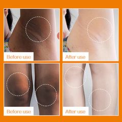 Kem Làm Trắng Nách Hàn Quốc Vitamin C 60g - Cải Thiện Da Sáng Mịn, Mờ Vết Thâm, Chăm Sóc Da Toàn Thân