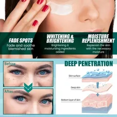 Kem Xóa Nám Tàn Nhang 30g - Tinh Chất Làm Trắng Da Mặt Hiệu Quả, Dưỡng Ẩm & Làm Sáng Đều Màu Da