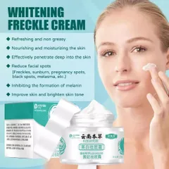 Kem Xóa Nám Tàn Nhang 30g - Tinh Chất Làm Trắng Da Mặt Hiệu Quả, Dưỡng Ẩm & Làm Sáng Đều Màu Da