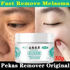 Kem Xóa Nám Tàn Nhang 30g - Tinh Chất Làm Trắng Da Mặt Hiệu Quả, Dưỡng Ẩm & Làm Sáng Đều Màu Da