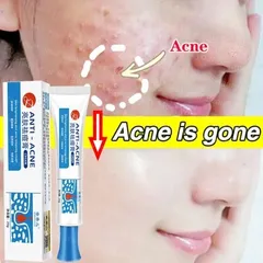 Gel Loại Bỏ Mụn - Kem Giảm Mụn Nhanh 25g, Hỗ Trợ Mờ Vết Thâm, Kiểm Soát Dầu, Phục Hồi Da, Sản Phẩm Chăm Sóc Da Chất Lượng