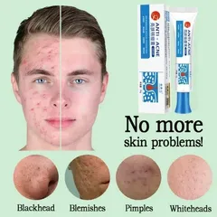 Gel Loại Bỏ Mụn - Kem Giảm Mụn Nhanh 25g, Hỗ Trợ Mờ Vết Thâm, Kiểm Soát Dầu, Phục Hồi Da, Sản Phẩm Chăm Sóc Da Chất Lượng