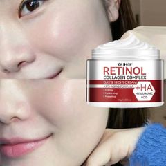 Kem Dưỡng Retinol 30g - Chống Lão Hóa, Phục Hồi Da, Tăng Độ Đàn Hồi, Giảm Nếp Nhăn, Hỗ Trợ Làm Mịn Da