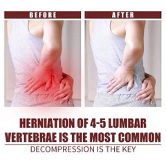 Bình Xịt Lạnh Giảm Đau Cột Sống Thắt Lưng 35ml - Giải Pháp Nhanh Chóng Cho Cơn Đau Mỏi Cơ Bắp và Khớp