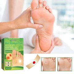 Gói 30 Miếng Dán Loại Bỏ Mụn Cóc - Gel Chăm Sóc Chân Ngón, Độ Mạnh Tối Đa, Giải Pháp Hiệu Quả Không Đau Đớn