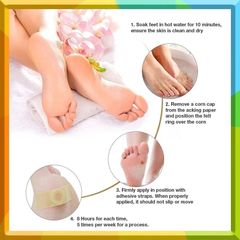 Gói 30 Miếng Dán Loại Bỏ Mụn Cóc - Gel Chăm Sóc Chân Ngón, Độ Mạnh Tối Đa, Giải Pháp Hiệu Quả Không Đau Đớn