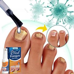 Bình Xịt Giảm Nấm Móng - Chăm Sóc Tay Chân Gia Truyền, Hỗ Trợ Khắc Phục Hư Khoé, Bọng Móng, Dễ Sử Dụng, Hiệu Quả Nhanh Chóng