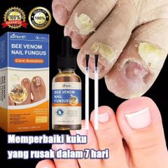 Tinh Chất Loại Bỏ Nấm Móng 50ML - Kem Phục Hồi Móng Tay, Chân Kháng Khuẩn, Chăm Sóc Móng Yếu, Hỗ Trợ Khôi Phục Sức Khỏe Móng