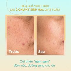 Tinh Chất Dưỡng Trắng Cấp Ẩm GUO Radiance 4X Ampoule 30ml - Serum Làm Mờ Thâm Sạm Dành Cho Bà Bầu, An Toàn Và Hiệu Quả