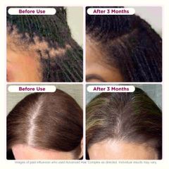 Viên Uống Biotin Hỗ Trợ Tóc - Nature's Bounty Hair Growth 90 Viên - Tăng cường sức khỏe tóc, ngăn rụng tóc hiệu quả