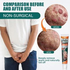 Kem Bôi Giảm Ngứa Vùng Kín SUMIFUN - Tinh Chất Thảo Mộc Hỗ Trợ Chăm Sóc Nấm, Mụn Sinh Dục, Sùi Mào Gà, 50g