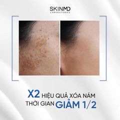 Serum SkinMD Pure Whitenol - Giảm Thâm, Mờ Nám, Làm Trắng Da An Toàn và Hiệu Quả cho Da Nhạy Cảm