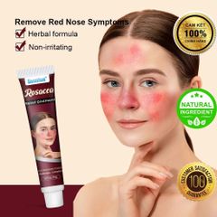 Kem Bôi Mũi Đỏ Rosacca - Giải Pháp Thảo Mộc 100% Cho Da Nhạy Cảm, Dị Ứng, Viêm Da Mặt, Hỗ Trợ Làm Dịu, Phục Hồi Da Tổn Thương