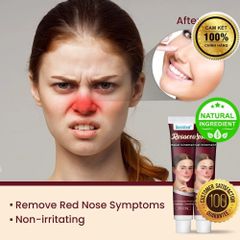 Kem Bôi Mũi Đỏ Rosacca - Giải Pháp Thảo Mộc 100% Cho Da Nhạy Cảm, Dị Ứng, Viêm Da Mặt, Hỗ Trợ Làm Dịu, Phục Hồi Da Tổn Thương