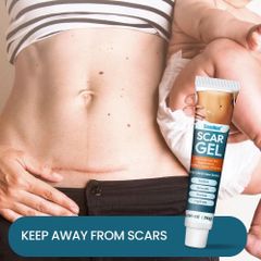 Gel Bôi Sẹo Mụn, Sẹo Thâm & Sẹo Bỏng SUMIFUN - Giải Pháp Nhanh Chóng Khôi Phục Da Tự Nhiên, Không Đau Rát