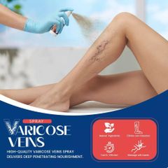 Chai Xịt Hỗ Trợ Suy Giãn Tĩnh Mạch 100% Thảo Mộc – Giảm Sưng, Nặng Chân, Tê Mỏi, Thẩm Thấu Nhanh, An Toàn Cho Da Nhạy Cảm