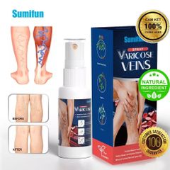 Chai Xịt Hỗ Trợ Suy Giãn Tĩnh Mạch 100% Thảo Mộc – Giảm Sưng, Nặng Chân, Tê Mỏi, Thẩm Thấu Nhanh, An Toàn Cho Da Nhạy Cảm
